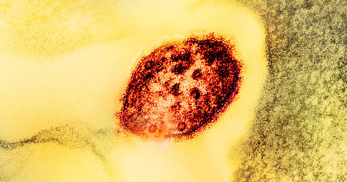 Colourized transmission electron micrograph of a measles virus particle (red), with a yellow background. Photo: CDC and NIAID. Licensed under Creative Commons CC BY 2.0 DEED Attribution 2.0 Generic license. https://creativecommons.org/licenses/by/2.0/