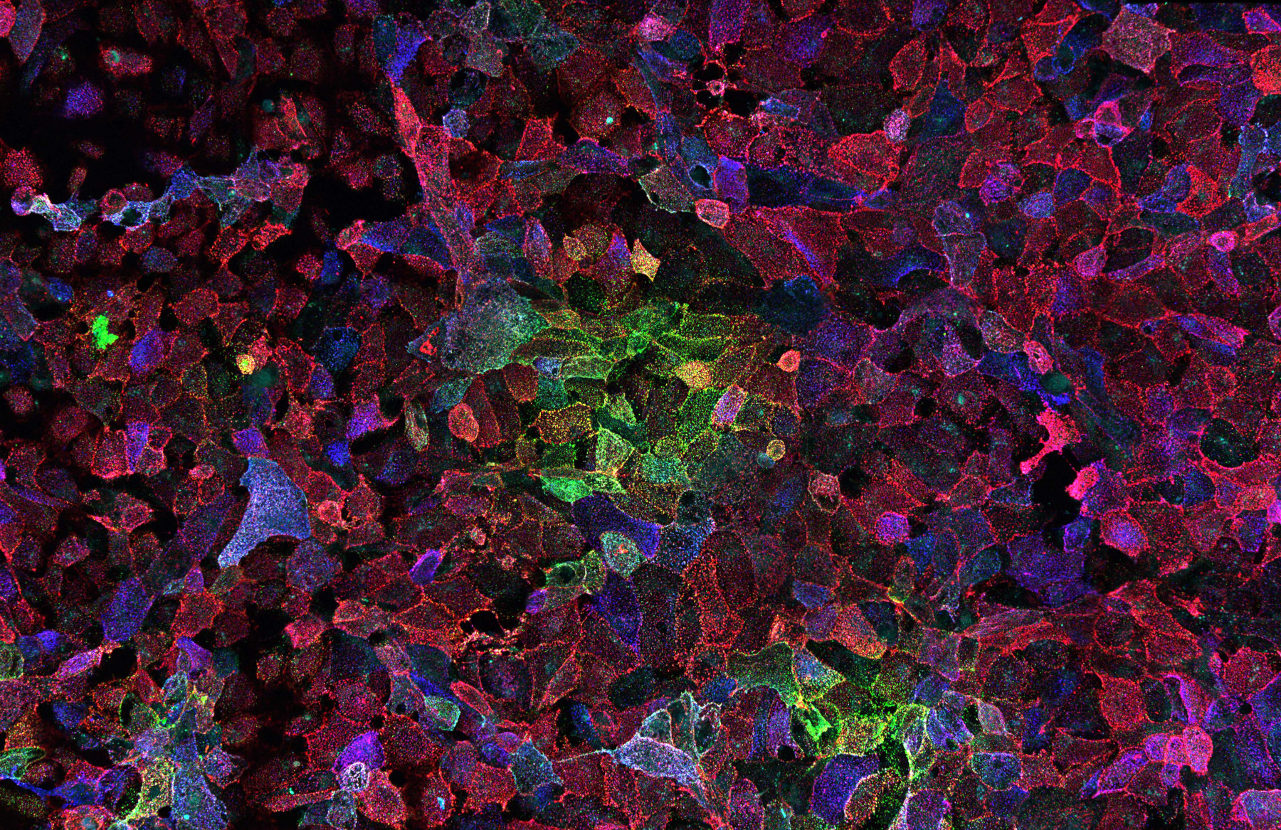 Photo of cells infected with SARS-CoV-2. The reds and greens in the image represent cells infected with the novel coronavirus that causes COVID-19. Photo: Alberto Domingo Lopez-Munoz, Laboratory of Viral Diseases, NIAID/NIH.