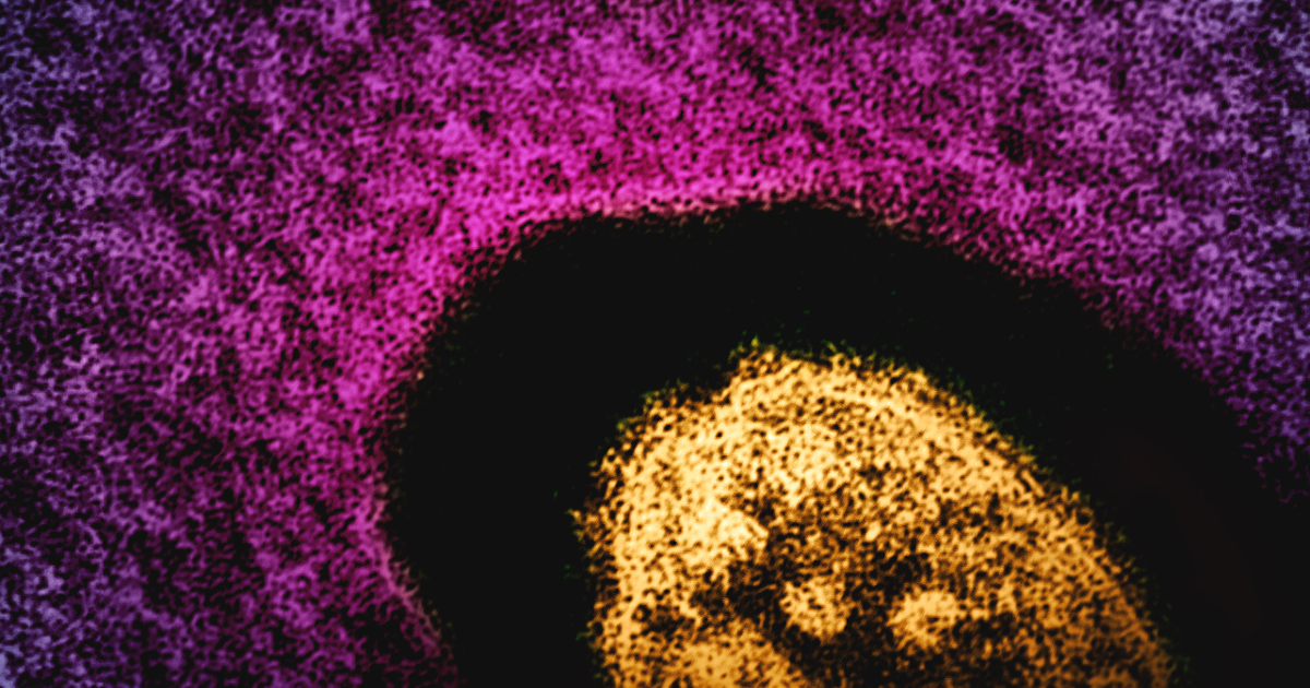 Colourized transmission electron micrograph of a measles virus particle (gold), with a purple background. Photo: CDC and NIAID. Licensed under Creative Commons CC BY 2.0 DEED Attribution 2.0 Generic license. https://creativecommons.org/licenses/by/2.0/