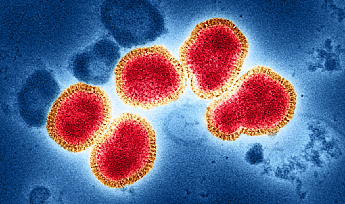 Colourized transmission electron micrograph of influenza A virus particles (red and gold), isolated from a patient sample and then propagated in cell culture. Blue background. This image features the H3N2 influenza strain. Photo: NIAID.