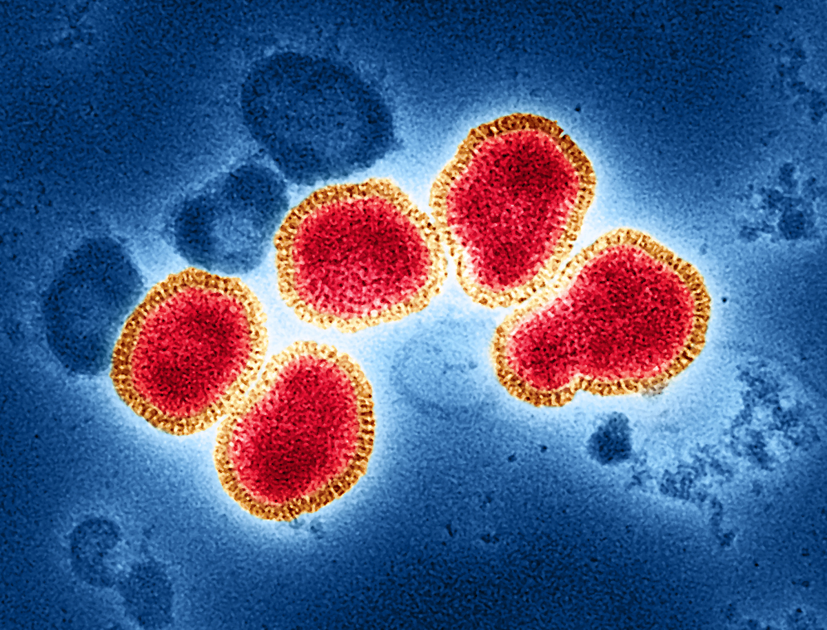 Colourized transmission electron micrograph of influenza A virus particles (red and gold), isolated from a patient sample and then propagated in cell culture. This image features the H3N2 influenza strain, isolated from a patient in Australia. Photo: NIAID.