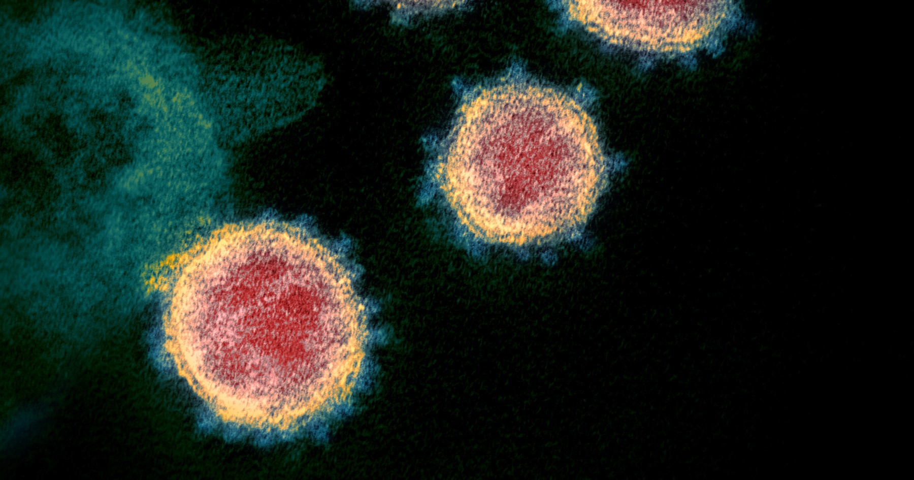 Image au microscope électronique de particules du virus SARS-CoV-2. Des particules de virus émergent de la surface de cellules cultivées en laboratoire. Image capturée et colorisée aux Rocky Mountain Laboratories de NIAID à Hamilton, Montana. Photo par : NIAID. Creative Commons CC BY 2.0 DEED Attribution 2.0 Licence générique : https://creativecommons.org/licenses/by/2.0/.