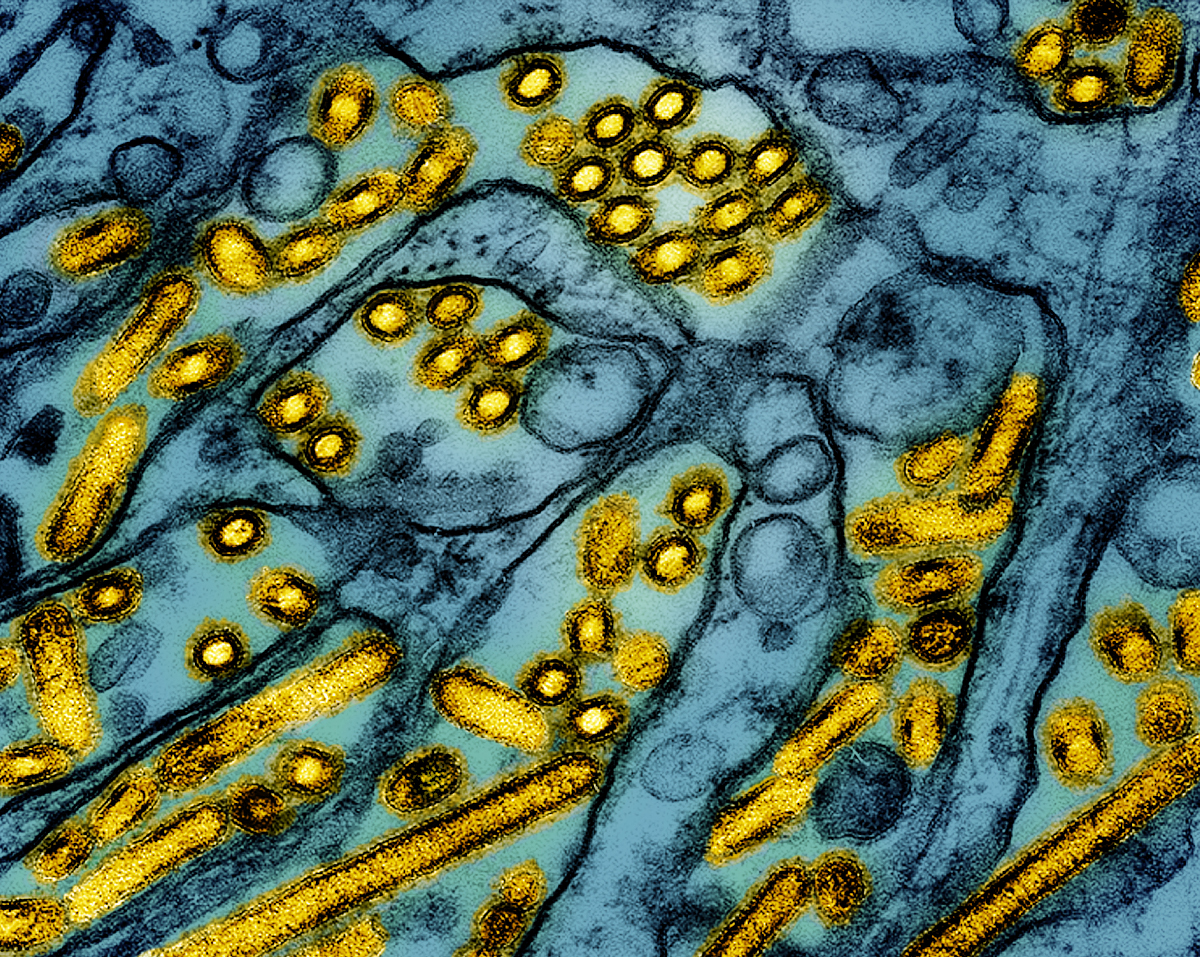 Micrographie électronique à transmission colorisée de particules du virus de la grippe aviaire A H5N1 (jaune), cultivées dans des cellules épithéliales rénales canines (bleues). Photo : CDC et NIAID.